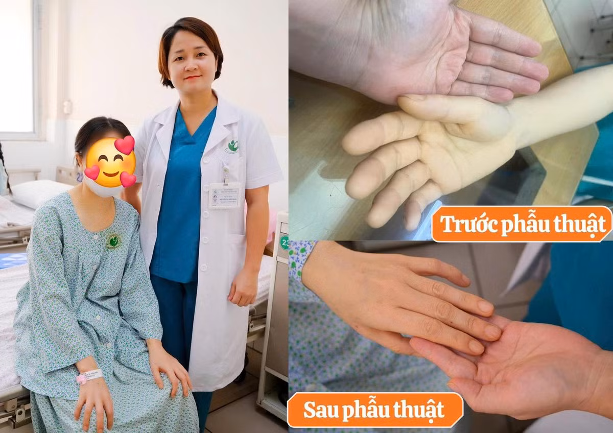 thieu-mau-u-xo.jpg