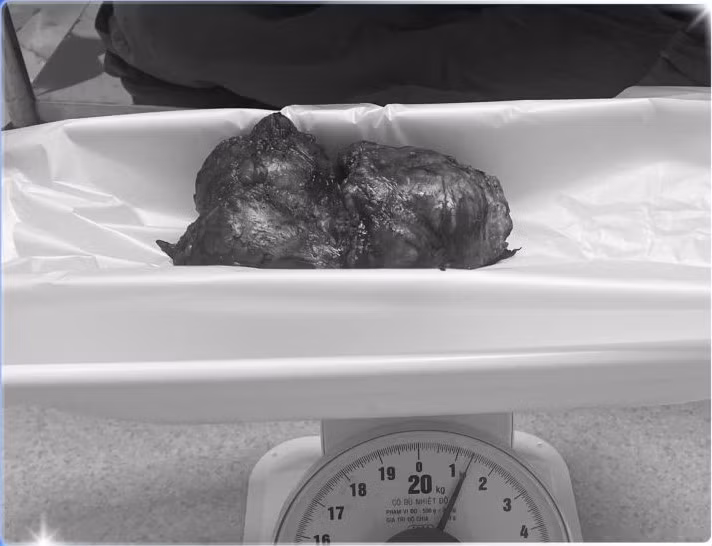 u-khong-lo-2.jpg