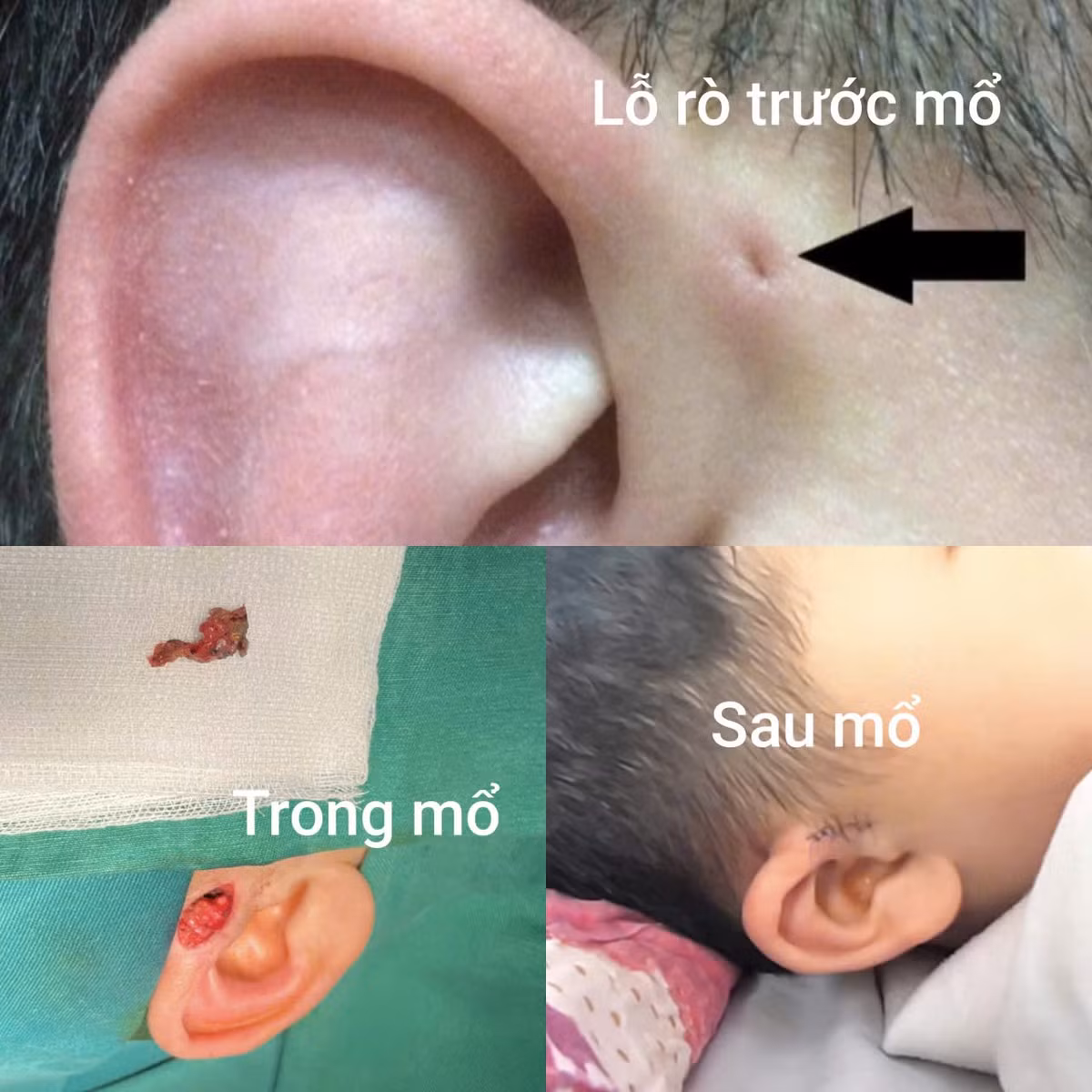 ro-luan-nhi.jpg