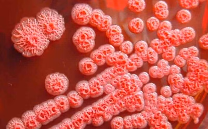 Vi khuẩn Burkholderia pseudomallei, tác nhân gây bệnh Whitmore - Ảnh BVCC