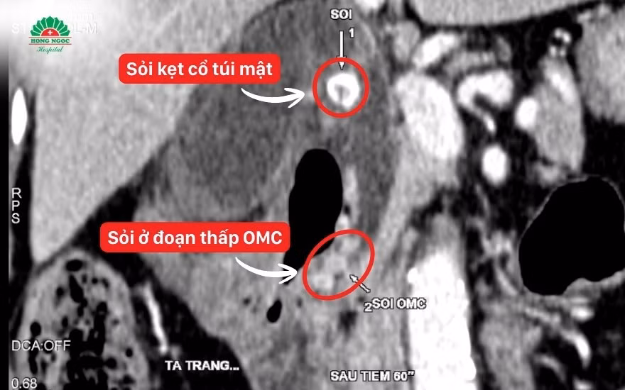 viem-tui-mat-hoai-tu.jpg