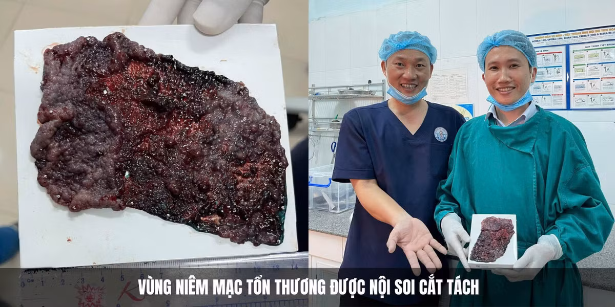 dai-tien-u.jpg