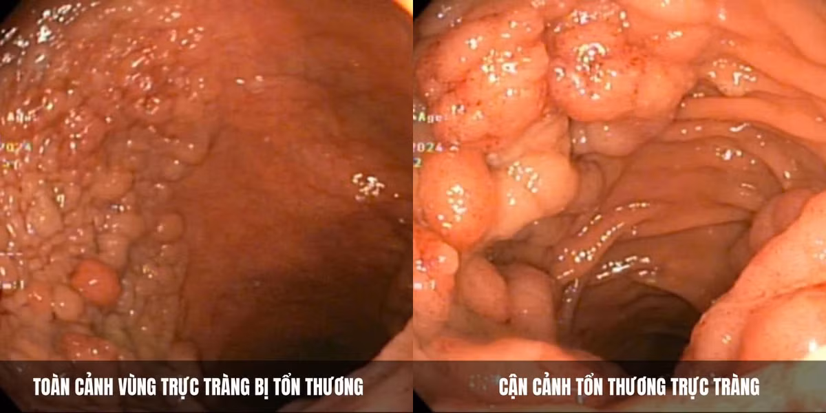 dai-tien-u-1.jpg
