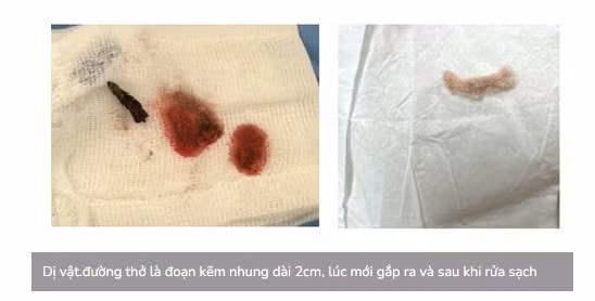 doan-kem-1.jpg