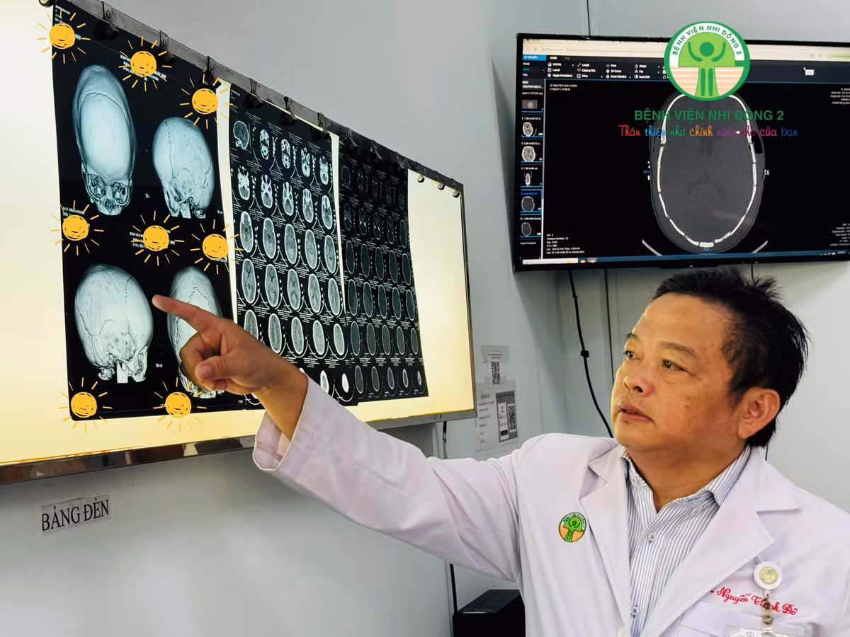 dinh-khop-1.jpg