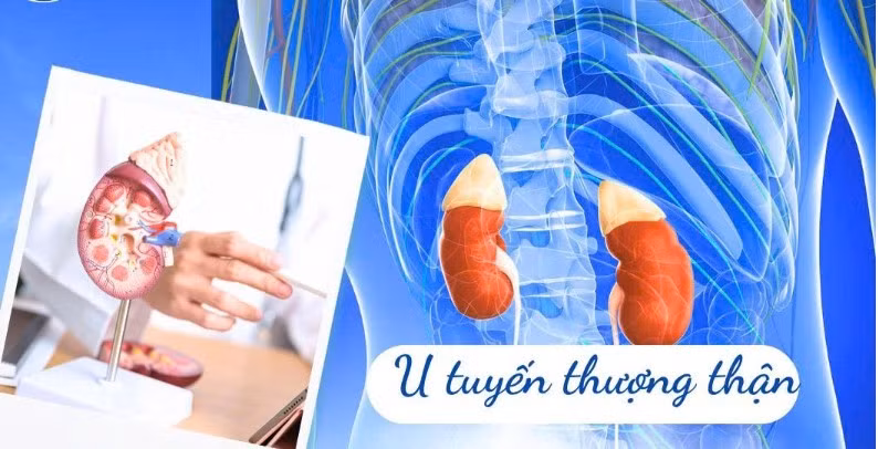u-tuyen-thuong-than.jpg