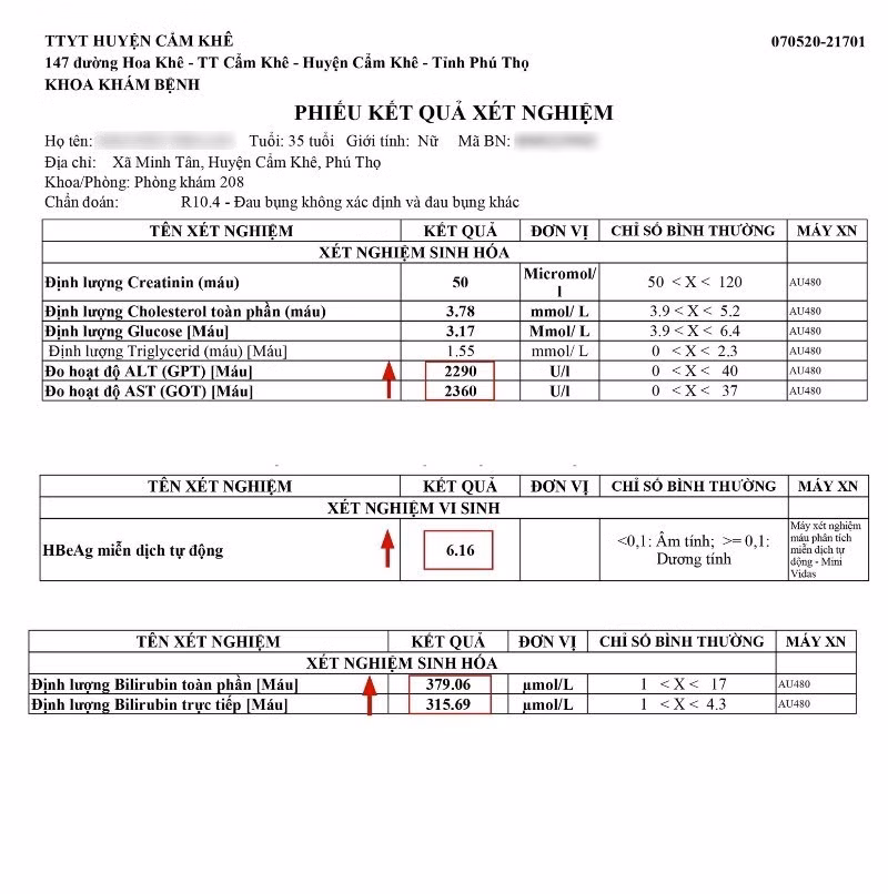 viem-gan-b-nh3-6896.jpg