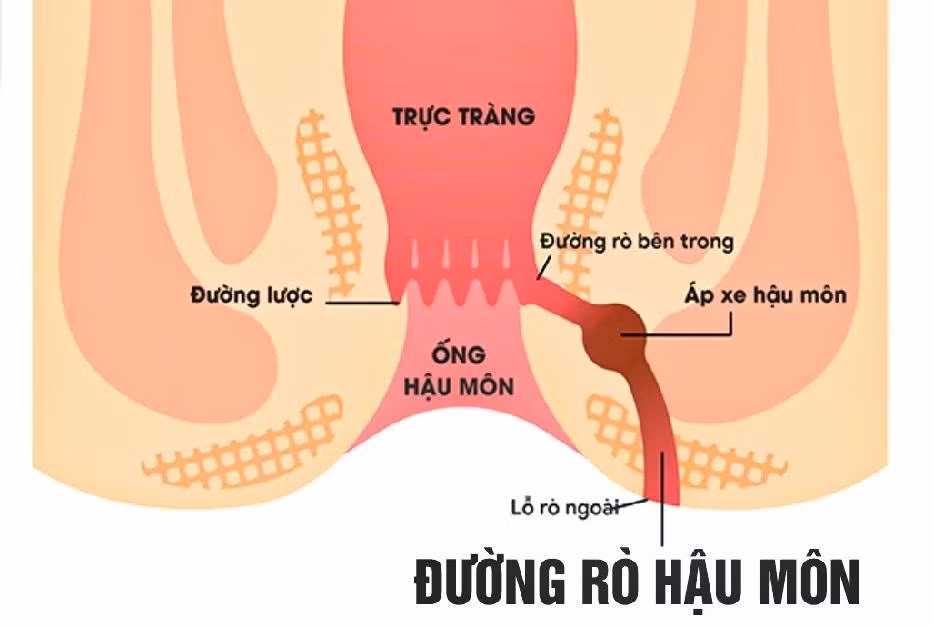 ro-hau-mon.jpg