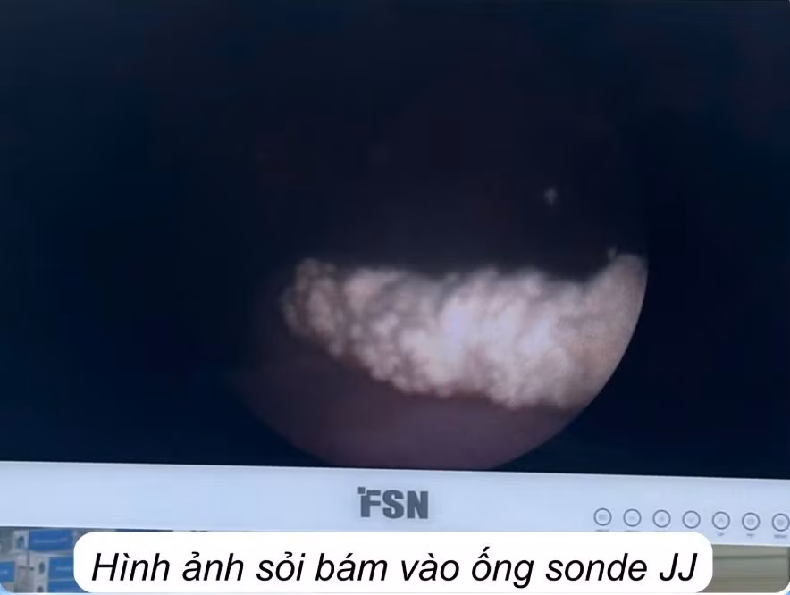 soi-bam-3.jpg