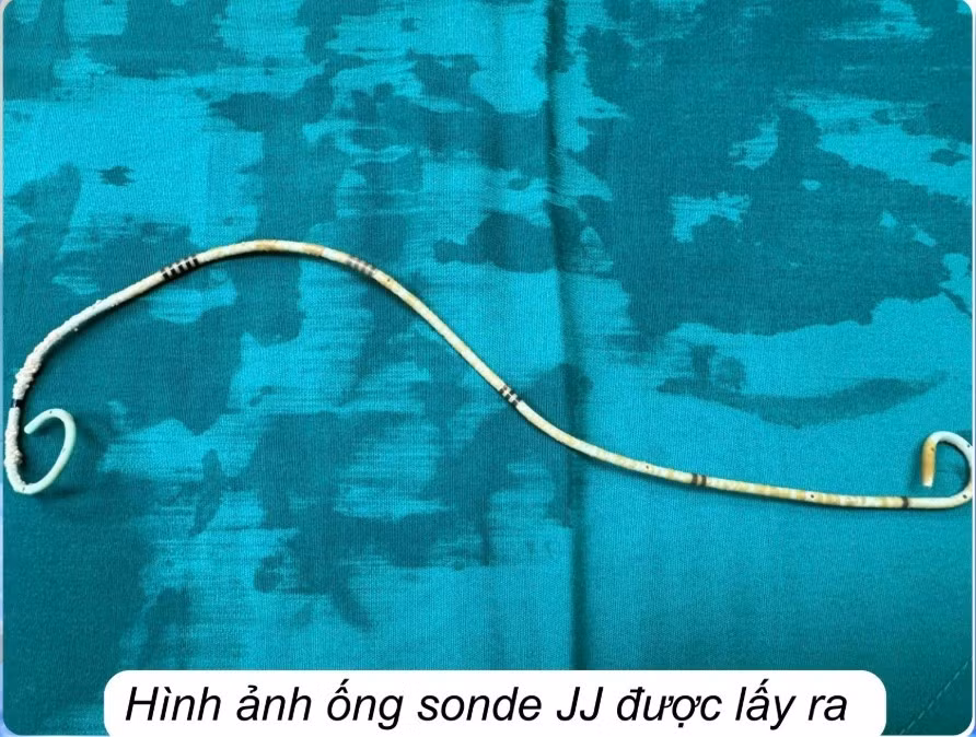 soi-bam-2.jpg