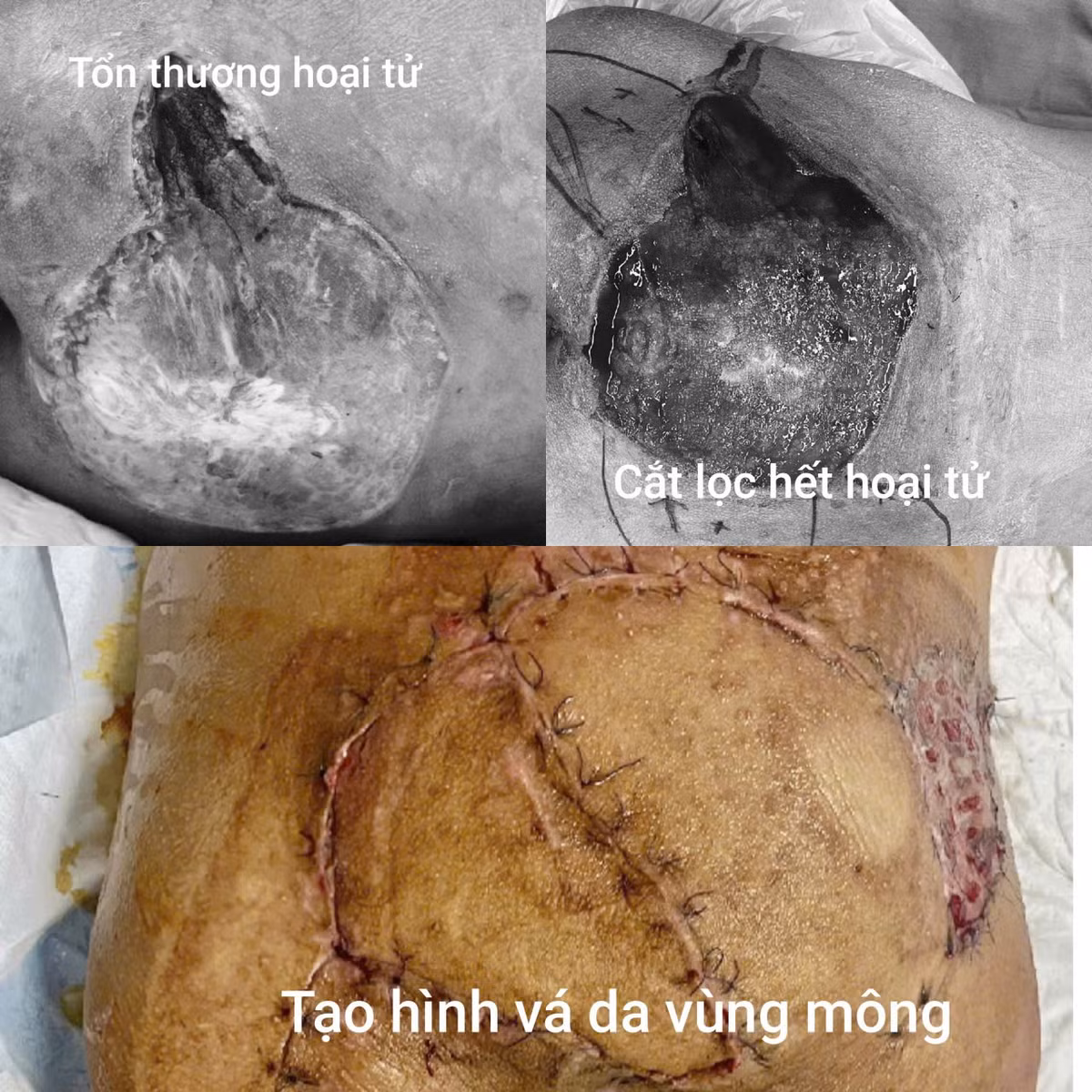 17-tuoi-3.jpg
