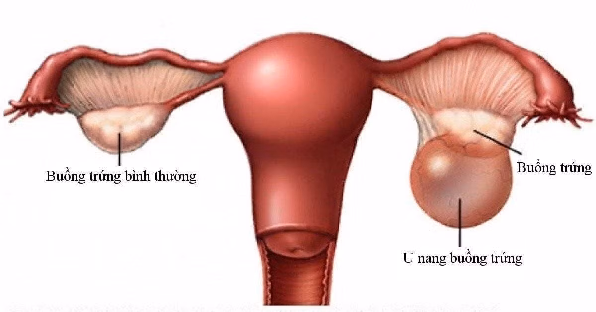 u-nang.jpg