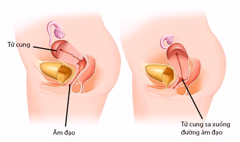 sa-sinh-duc.jpg