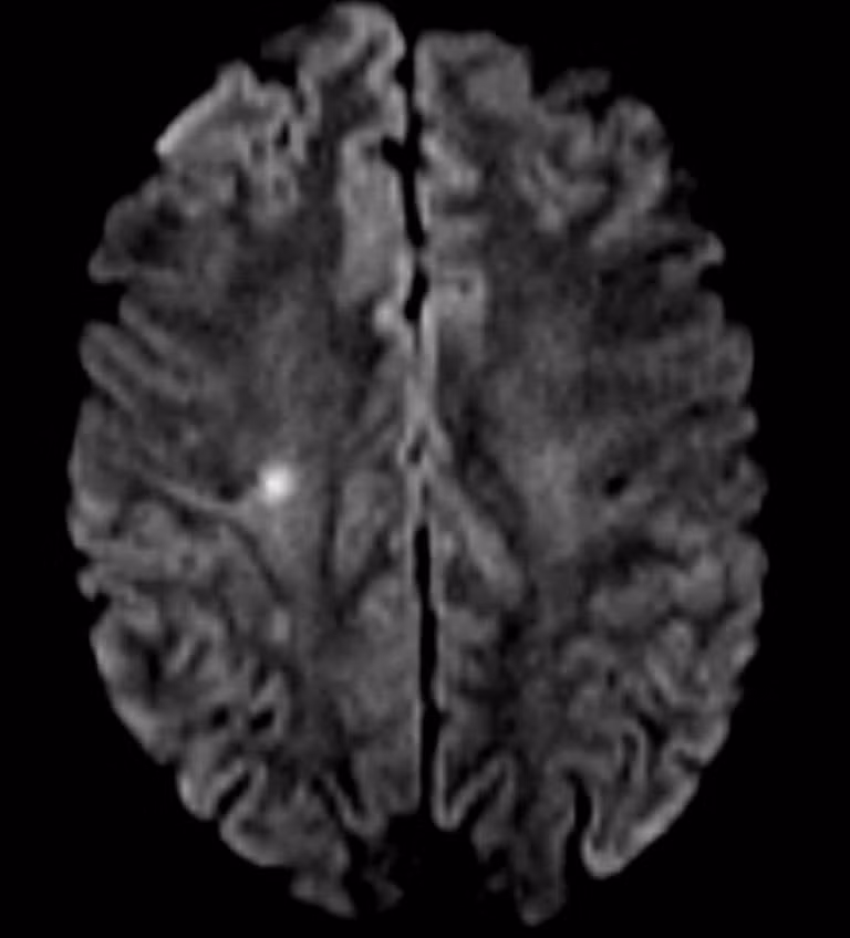 du-khach-my-1hinh-ton-thuong-nao-tren-phim-mri-2-768x848.jpg