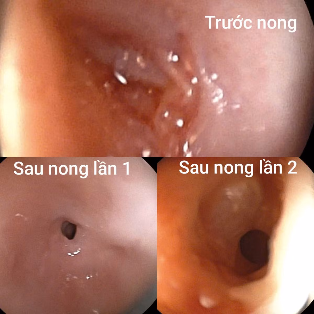 nong.jpg