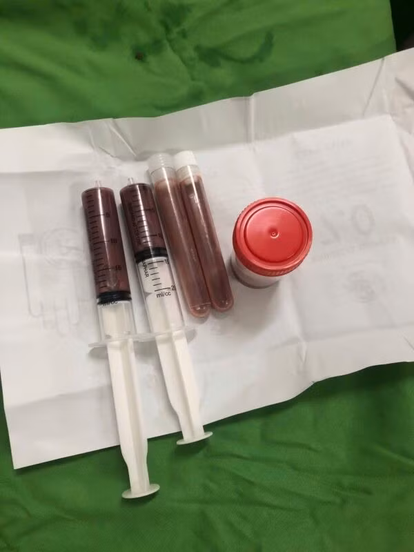 ap-xe-gan-2.jpg
