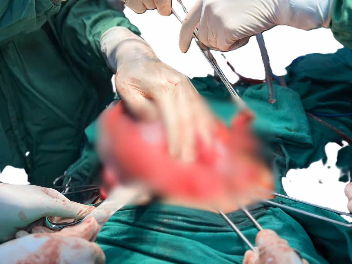 vo-ruot-thua-2.jpg