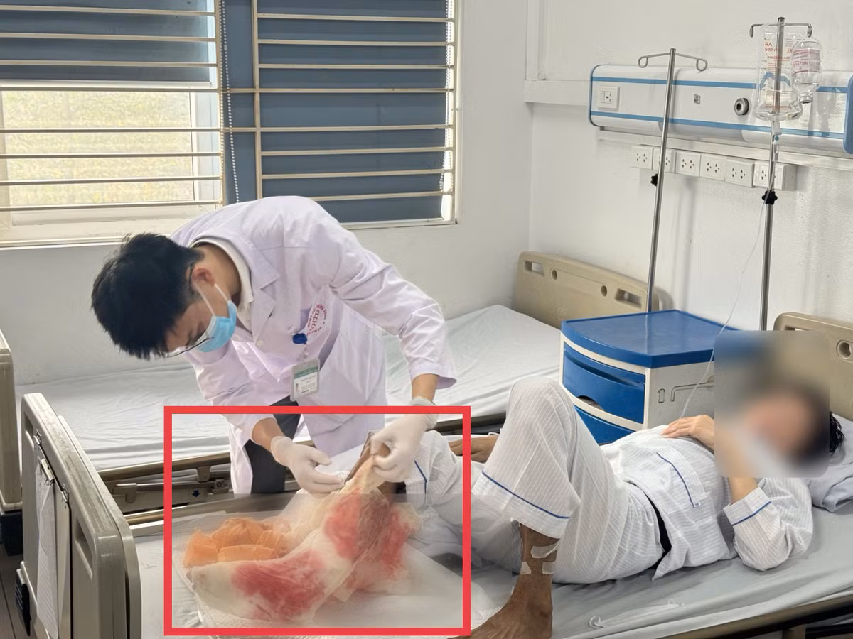 hoai-tu-bong.jpg