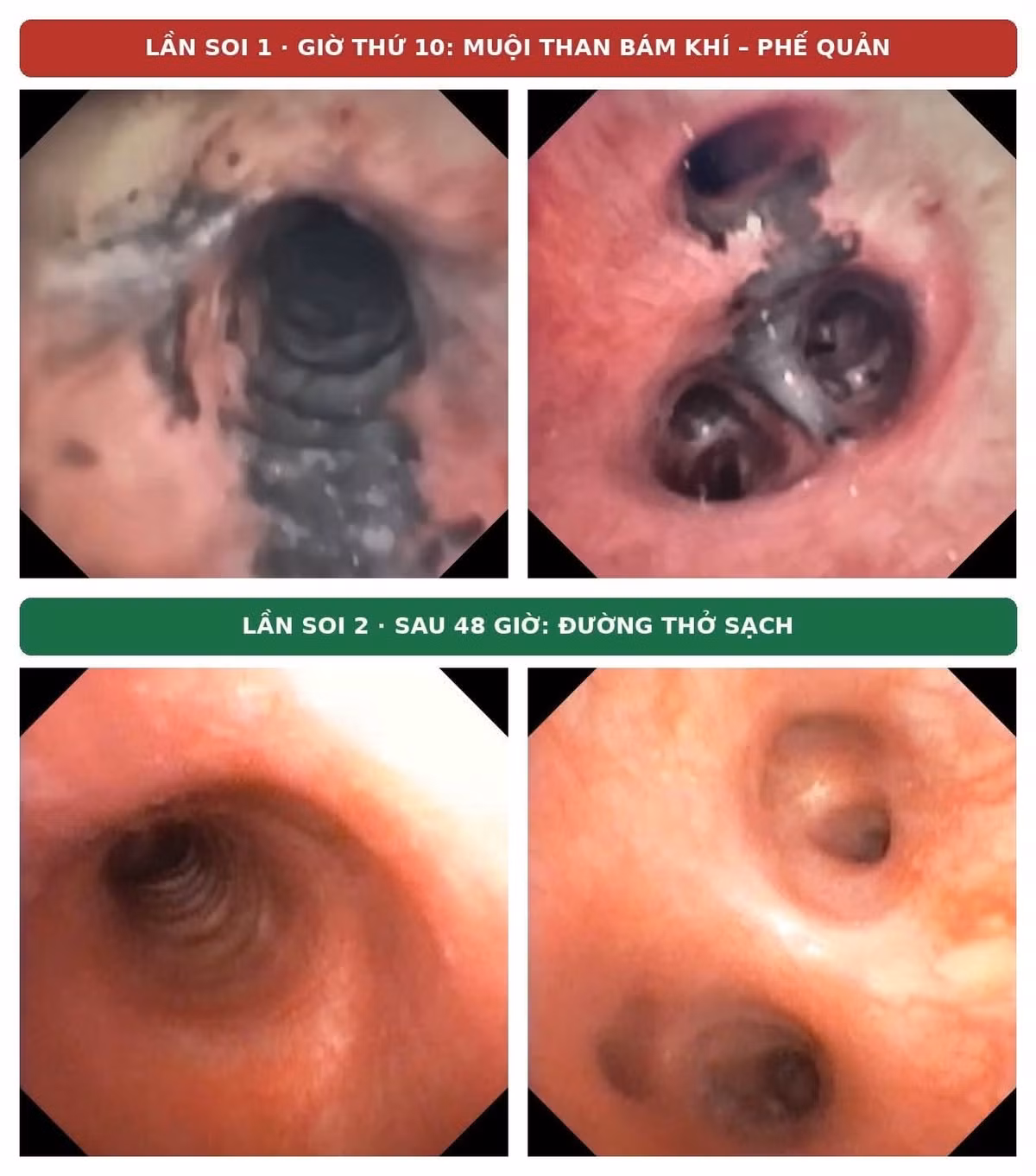 chay-sac-7288.jpg