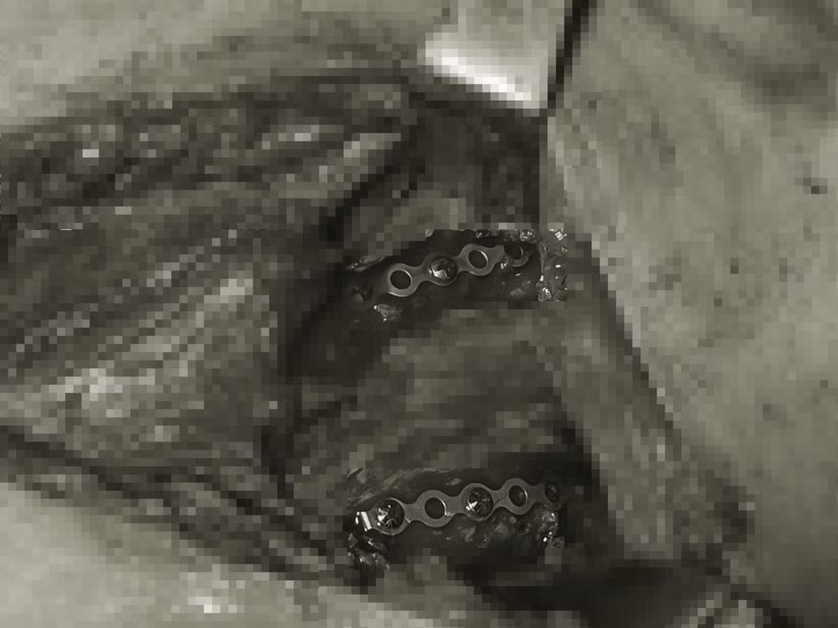 ket-hop-1.jpg