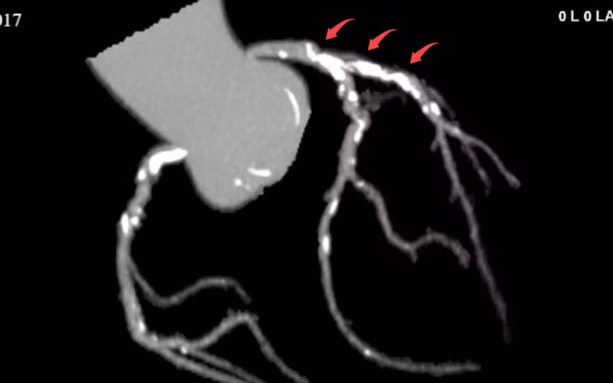 pha-voi.png