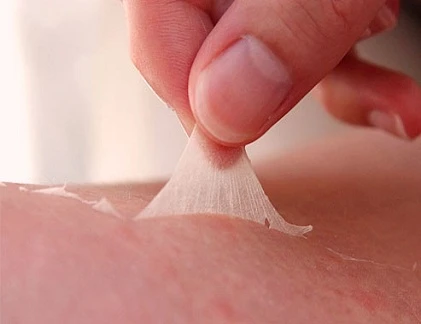Hình ảnh chứng tỏ bạn bị ung thư da (3)
