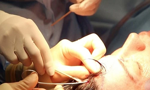 Ảnh dao kéo 100% cơ thể của chàng búp bê sống