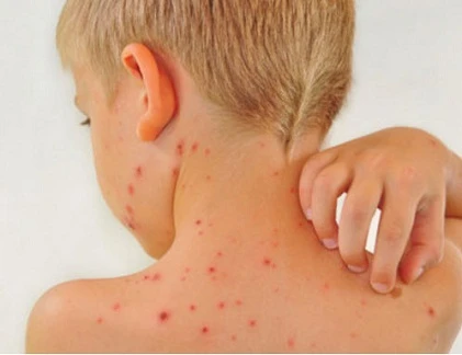 Tác hại không ngờ khi trẻ ăn quá nhiều đồ ngọt