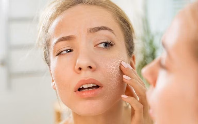 Mùa hanh khô khiến làn da dễ mất nước, khô ráp, xỉn màu và nhanh lão hóa. Việc bổ sung nước và dưỡng chất từ bên trong trở thành yếu tố quan trọng để duy trì làn da khỏe mạnh, mịn màng trong những ngày giao mùa. Ảnh minh họa
