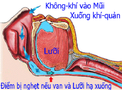  Ngủ ngáy chủ yếu là do các mô cơ ở cổ họng bị xẹp xuống khi nằm thẳng, dẫn đến đường lưu thông khí bị hẹp, luồng khí đi qua sẽ khiến các mô cơ rung lên và phát ra tiếng ngáy.