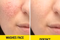 Hậu quả rửa mặt khi tắm, dưỡng da cầu kì đến mấy cũng vô ích