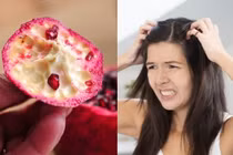 Người đang khốn khổ vì gàu, ăn xong 3 loại quả này đừng vội vứt vỏ đi