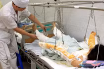 Nữ điều dưỡng bị bỏng ngực vì nướng mực ở bệnh viện