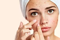 Ăn những thực phẩm này không bao giờ bị mụn trứng cá