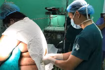 Cảnh báo những ca sinh mổ đặc biệt nguy hiểm vì sản phụ “quá khổ”