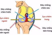 Chấn thương rách sụn chêm như Văn Toàn nguy hiểm ra sao?