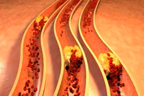 Những sự thật về cholesterol không phải ai cũng biết