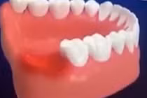 Trải nghiệm thực tế quá trình nhổ răng khôn trong chỉ với 7 phút tại Shinbi Dental