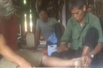 Vạch trần thủ đoạn cắn vào người bệnh lấy đá “độc” của thầy bói