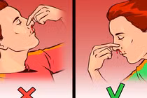 Sai lầm khi xử lý chảy máu cam nhiều người mắc phải