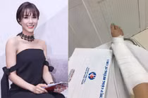 Diệp Lâm Anh bị gãy xương mắt cá chân trên trường quay 