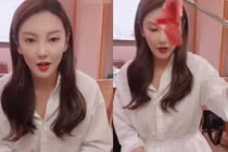 “Mỹ nhân ngư” Trương Vũ Kỳ lộ mặt nhọn hoắt gây sốc