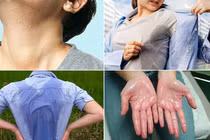 Cơ thể đổ mồ hôi bất thường đi khám ngay coi chừng bệnh nặng
