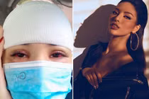Người mẫu Khả Trang bị tai nạn, tụ máu đầu giờ ra sao?