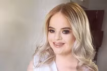 Hot girl mắc bệnh Down và mơ ước thành người mẫu quốc tế