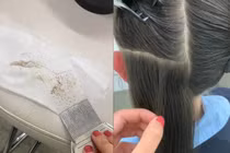 Chải tóc cho khách, thợ làm tóc nổi da gà vì hàng trăm trứng chấy 