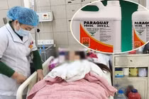 Cãi nhau với bạn, bé gái uống thuốc diệt cỏ làm cháy phổi