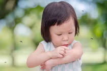 Người ăn nhiều thịt thu hút muỗi hơn? Chuyên gia giải đáp