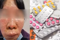 Bệnh nhân pha lẫn 7 loại thuốc để uống, bác sĩ hết hồn 
