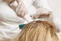 Mỗi tháng nhuộm tóc 2 lần, cô gái trẻ khiến gan tổn thương nặng